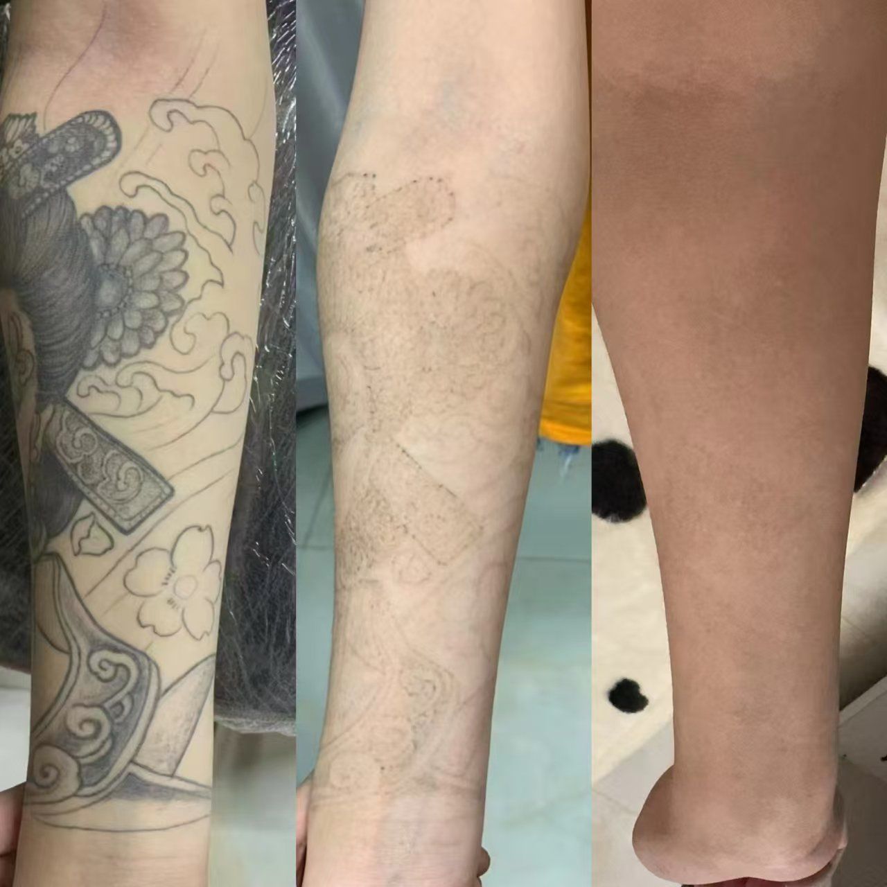洗纹身3次