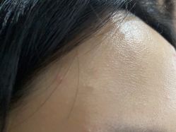 -广州美莱医疗美容医院