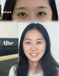 -AM半永久纹眉
