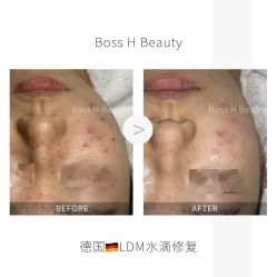 -Boss H Beauty美肌中心