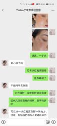 体验后-Yestar宁波艺星整形医院