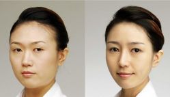 -CMS西美斯·美式医疗美容