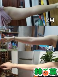 -Fundi张玉珊修身堂·indiba·BTL科技瘦身
