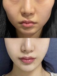 -上海伊莱美医疗美容医院