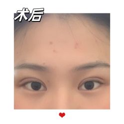 -素美医疗美容·西南眼鼻整形·修复基地