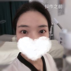 -YIMEI ART半永久纹眉·野生眉
