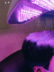 -碧莲盛·不剃发植发