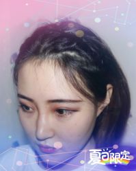 -大麦微针植发全国连锁