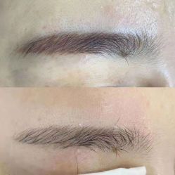 -莱尚·皮肤管理·痘肌护理