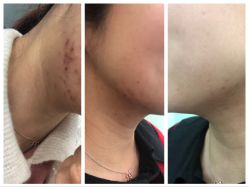 -SKINIST丽铂医疗美容