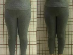 -修申骨雕小颜脊柱骨盆管理产后修复
