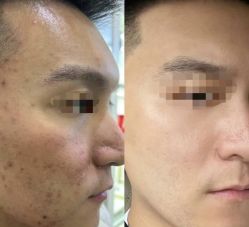 -康美贞·痘肌养护管理中心
