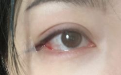 体验后-上海首尔丽格医疗美容医院