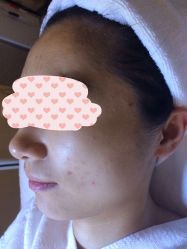 -皇族养心堂·净痘·修敏·御颜