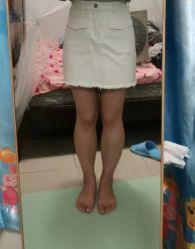 体验前-深圳美莱医疗美容医院