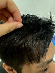 -熙朵美学植发·连锁品牌