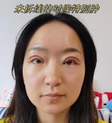 -素美医疗美容·西南眼鼻整形·修复基地