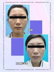 -联合丽格·张菡丽格医疗美容