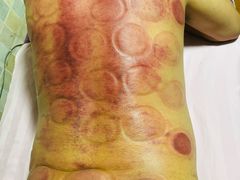 -沈师傅盲人按摩工作室(密三小区店)