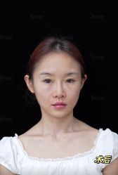 -Yestar重庆艺星医疗美容医院