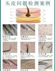 -希梵尔头皮抗衰·科技养发