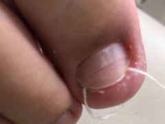 -新甲连锁灰指甲·甲沟炎·鸡眼(黑龙江路店)