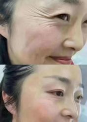 点击看大图 -YESIDO椰岛美容