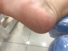 -世龙世家甲沟炎·灰指甲·嵌甲矫正·修脚(武侯区双楠店)