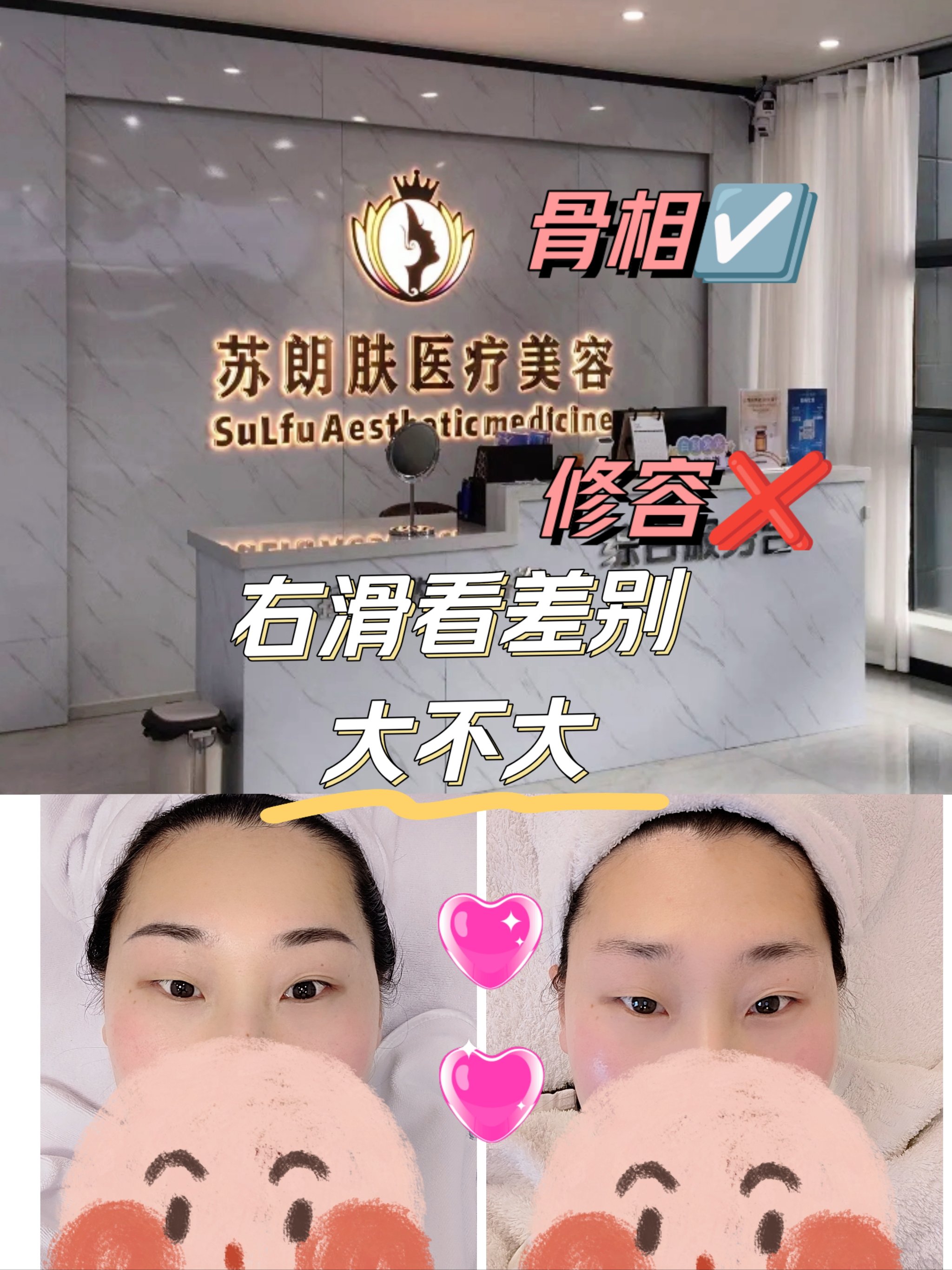 面相三阳图片图片