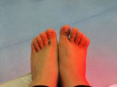 -新甲连锁灰指甲·甲沟炎·鸡眼(黑龙江路店)