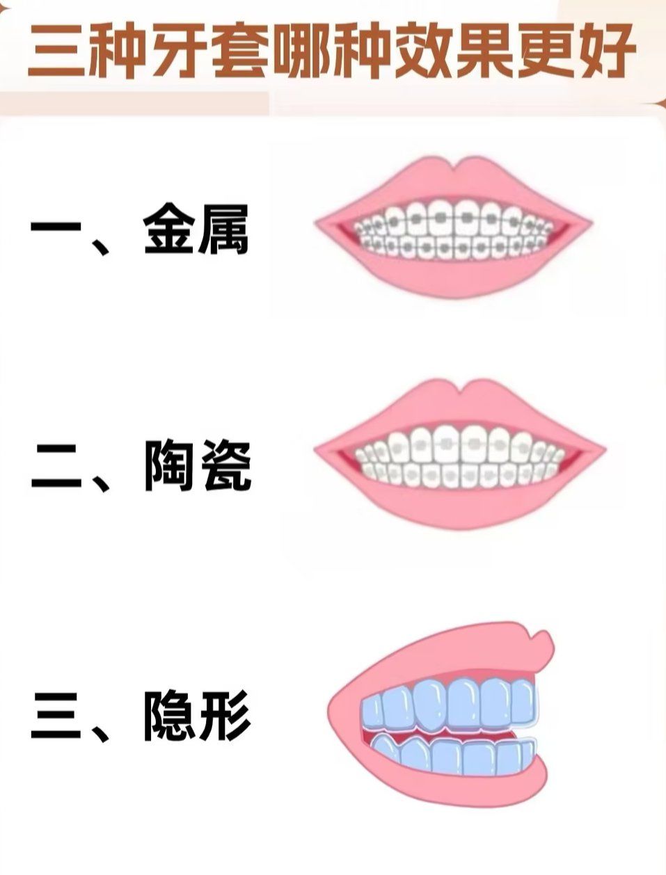隐形牙套使用的注意事项主要有以下这些