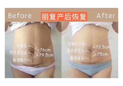 -丽复产后康复萧山旗舰中心