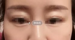 -新美荟医美·专注面部美学抗衰