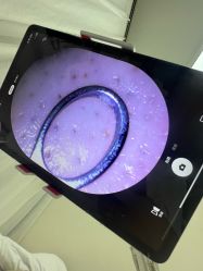 -凡碧诗毛孔清洁收细