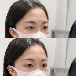点击看大图 -张小野·专业半永久纹眉