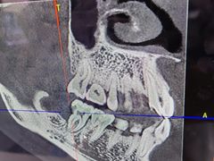 -Dr.Z dental仁康种植矫正中心