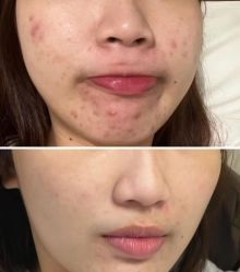 -SOS修丽可.痘肌修复中心