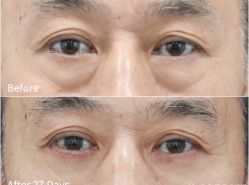 -丰联丽格医疗美容·联合丽格眼整形中心