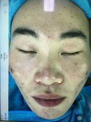 点击看大图 -肤原祛痘·科技修肤中心