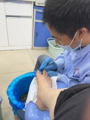 -德哥灰指甲脚气甲沟炎跖疣护理