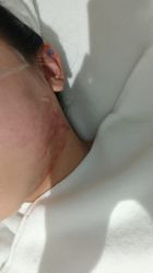 -叶美人医疗美容