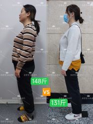 -苗塑堂减肥·艾灸
