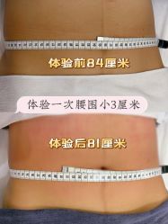 -Lily纤美·科技减脂中心