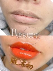 -RC半永久纹眉纹发际线