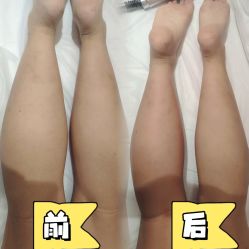 -Lily纤美·科技减脂中心