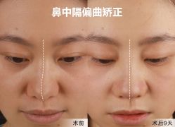 -北京米扬丽格医疗美容·联合丽格鼻整形中心