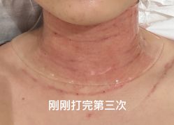 -深圳米兰柏羽医疗美容医院