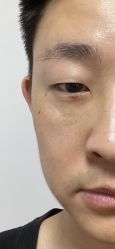 -Yestar宁波艺星整形医院