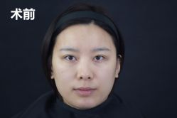-AIST爱思特医疗美容医院