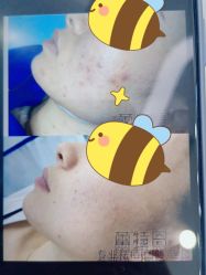 点击看大图 -蕾特恩专业祛痘·皮肤管理